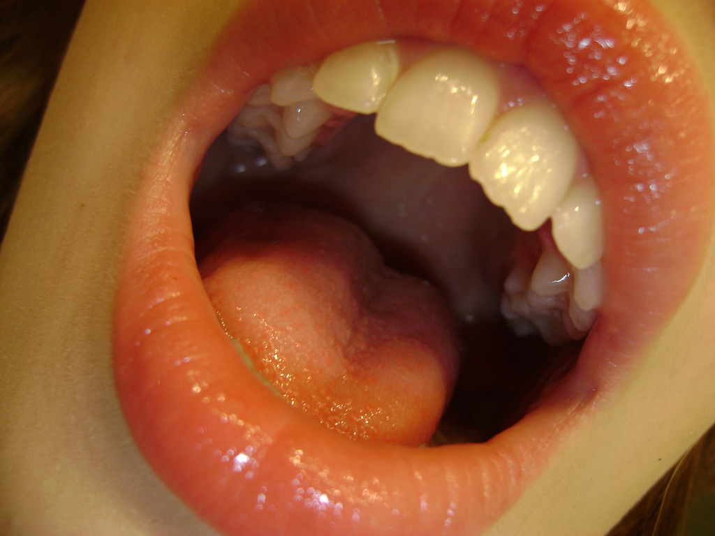 -Close-up-Tongue-Teeth-Open-Mouth- (photo from i-moc.com)